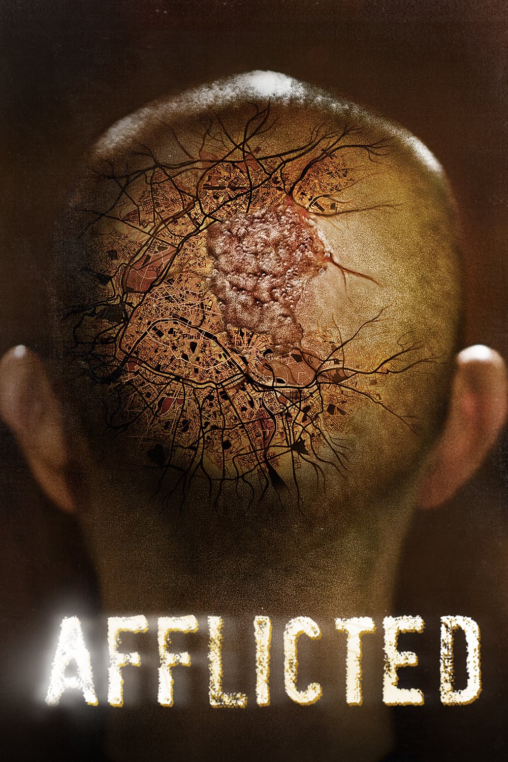 ดูหนังออนไลน์ฟรี Afflicted มหาภัยเชื้อเหนือมนุษย์